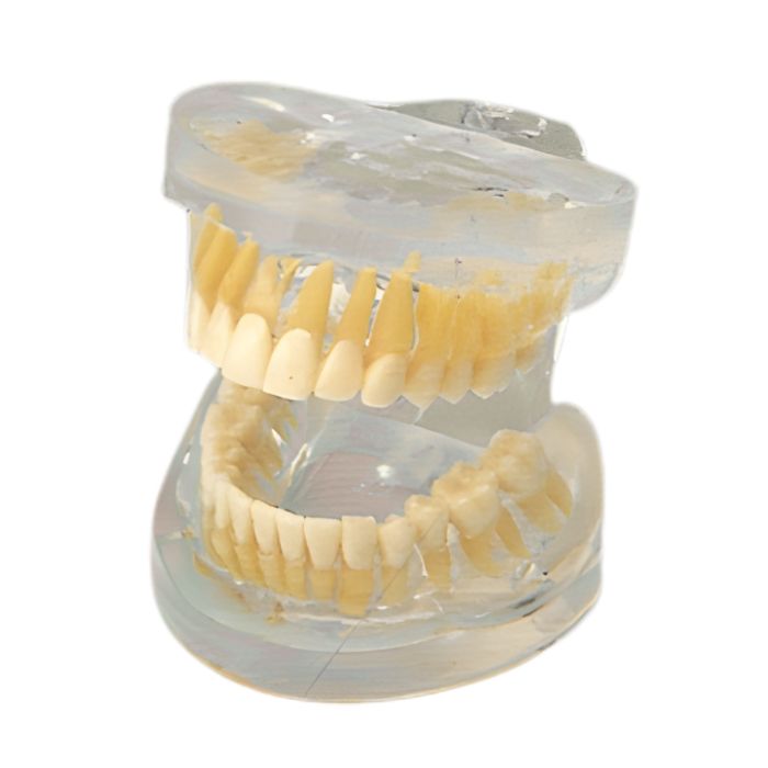 Transparent Adult Teeth Model
