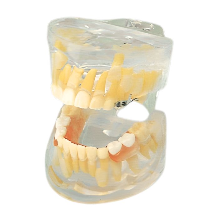 Transparent Milk Teeth Development Model