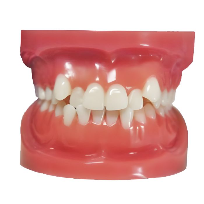 Orthodontic Model